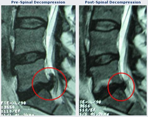 DTS mri