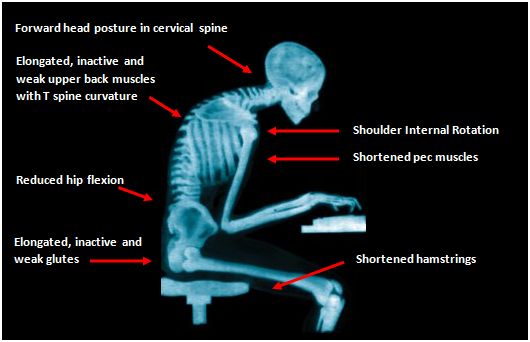 xray desk jockey